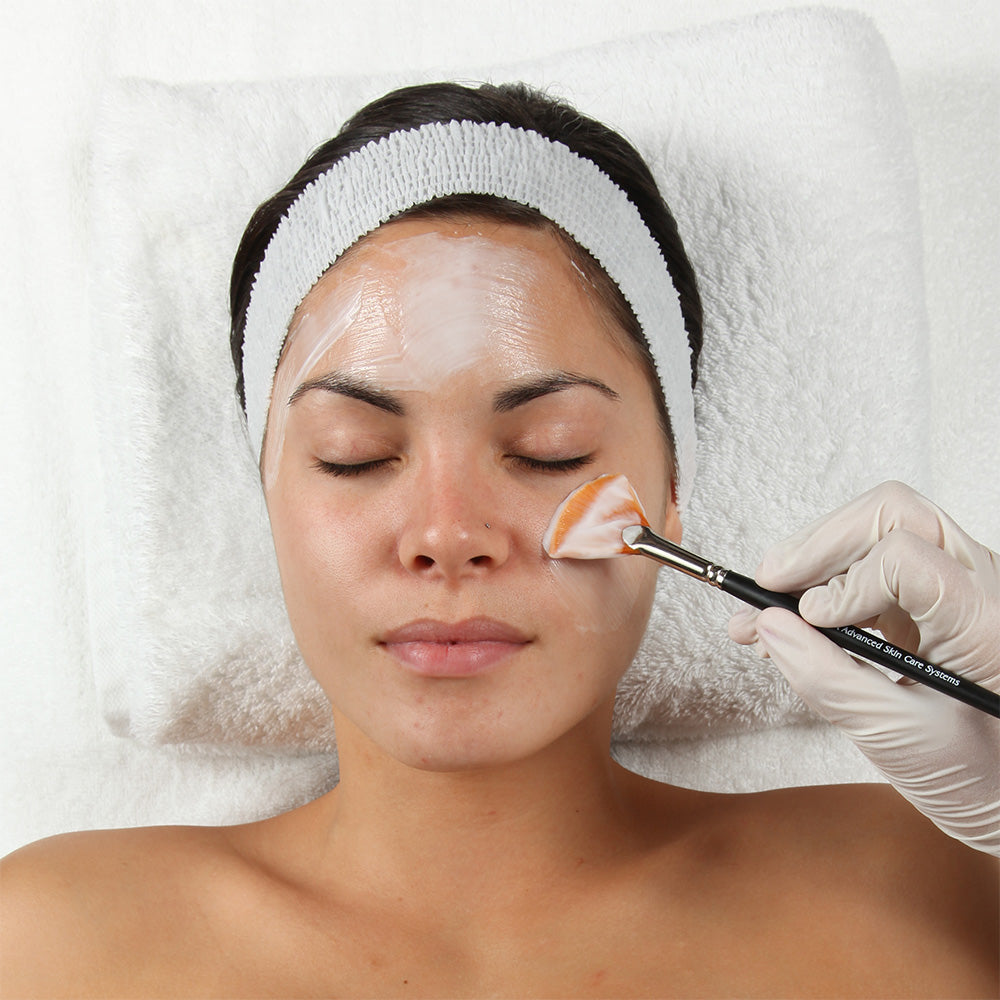 Skin Peels