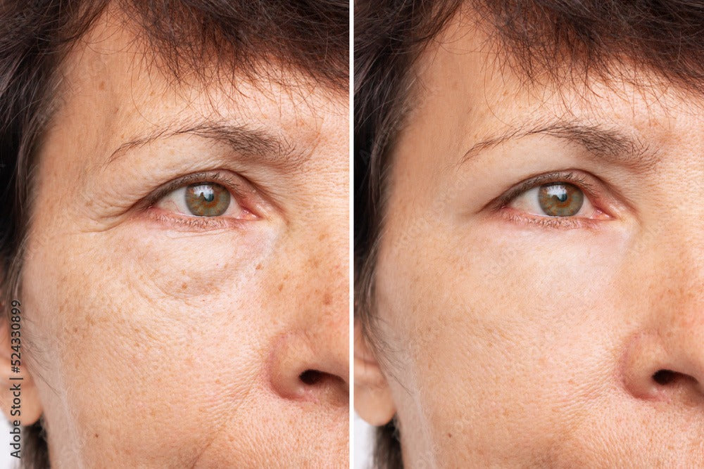 Causes of Dull Skin