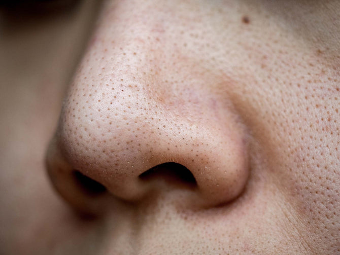 The Ultimate Guide to Removing Blackheads from Your Nose – Skin To ...