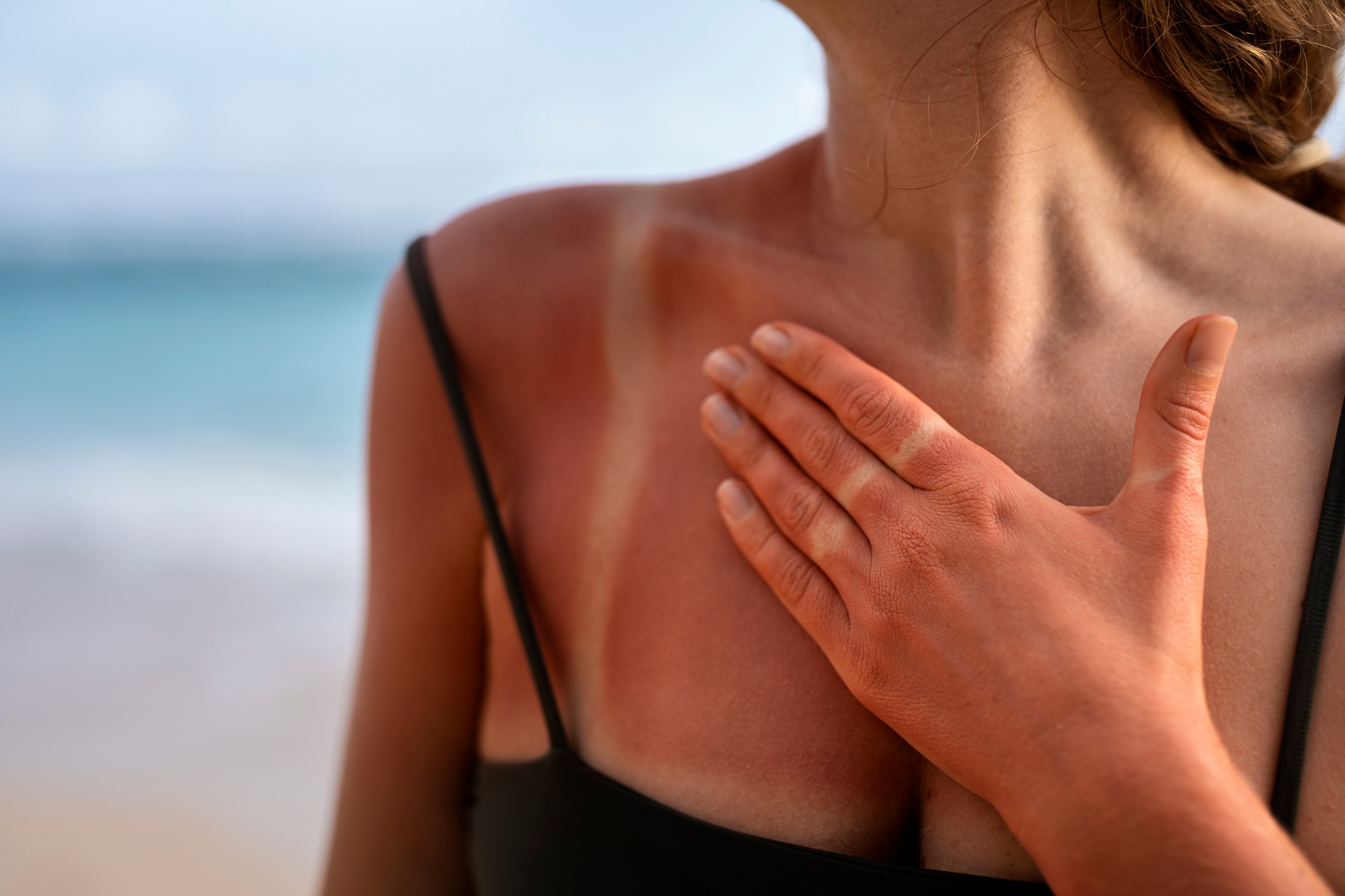 how to repair sun-damaged skin