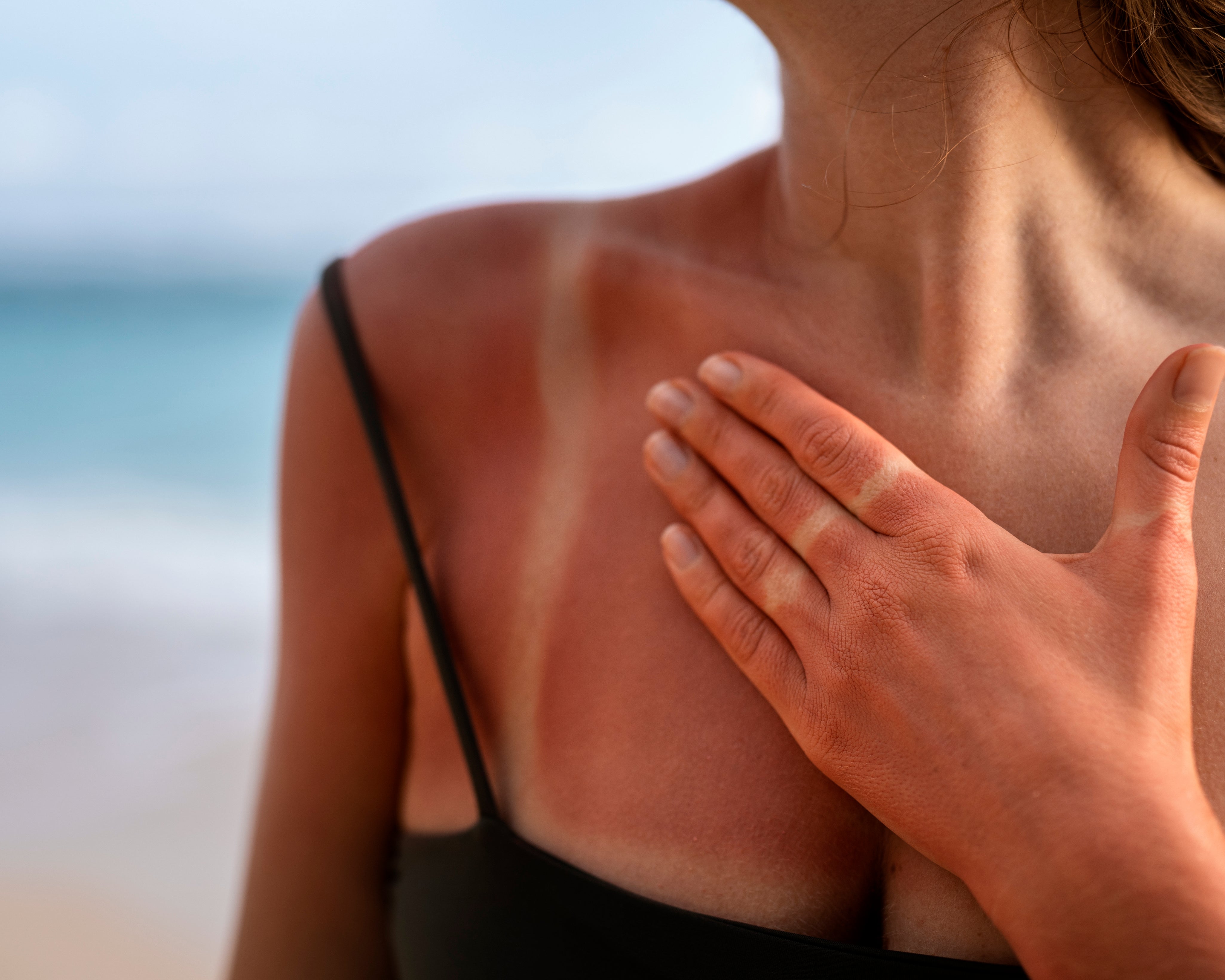 how to repair sun-damaged skin