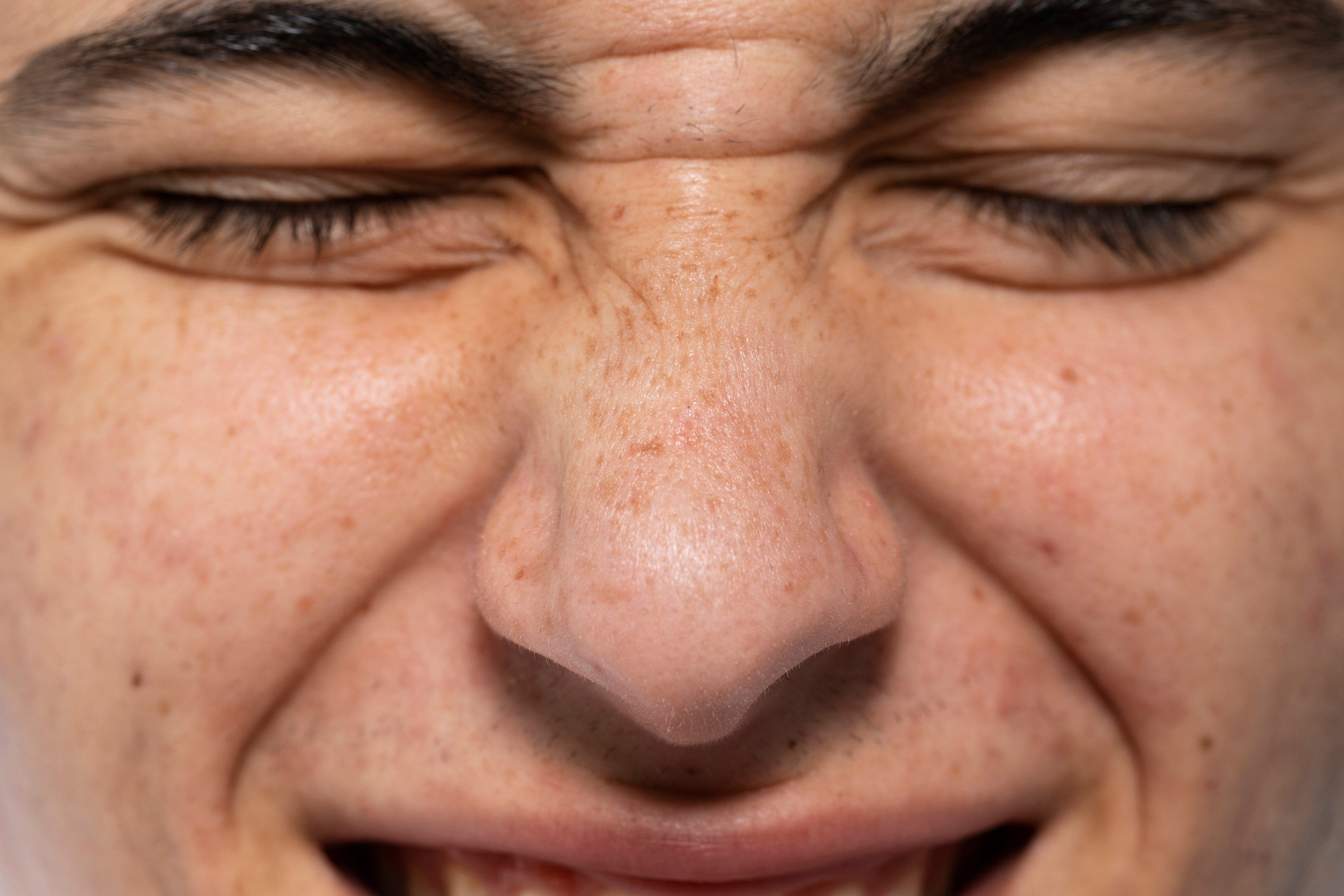 How to Minimise Enlarged Pores on Your Nose (Without Making Them Worse)