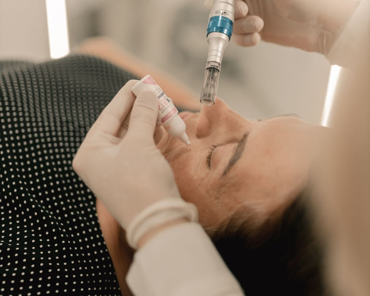 microneedling