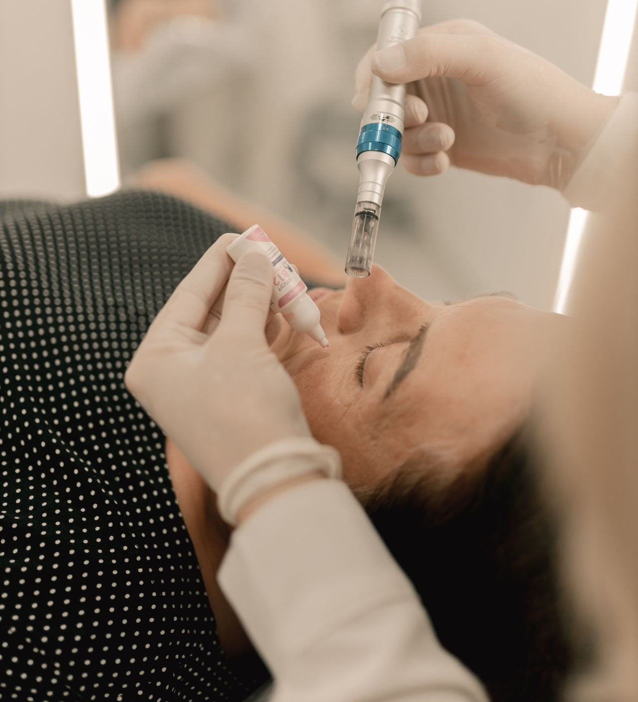 microneedling