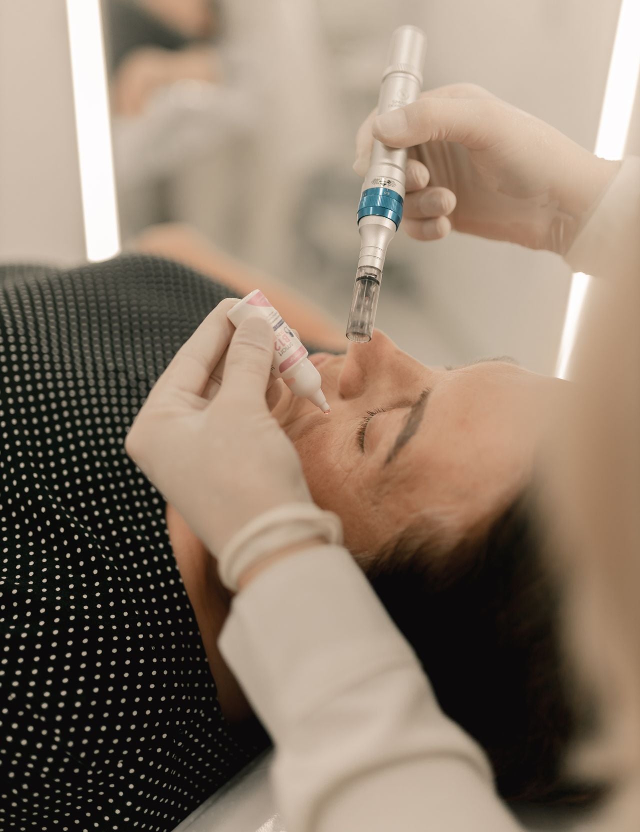 microneedling