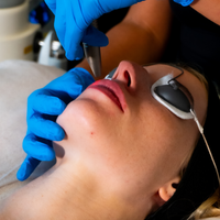 Fotona Tighten & Boost