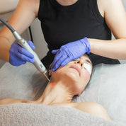 Biorepeel & Laser/Microneedling