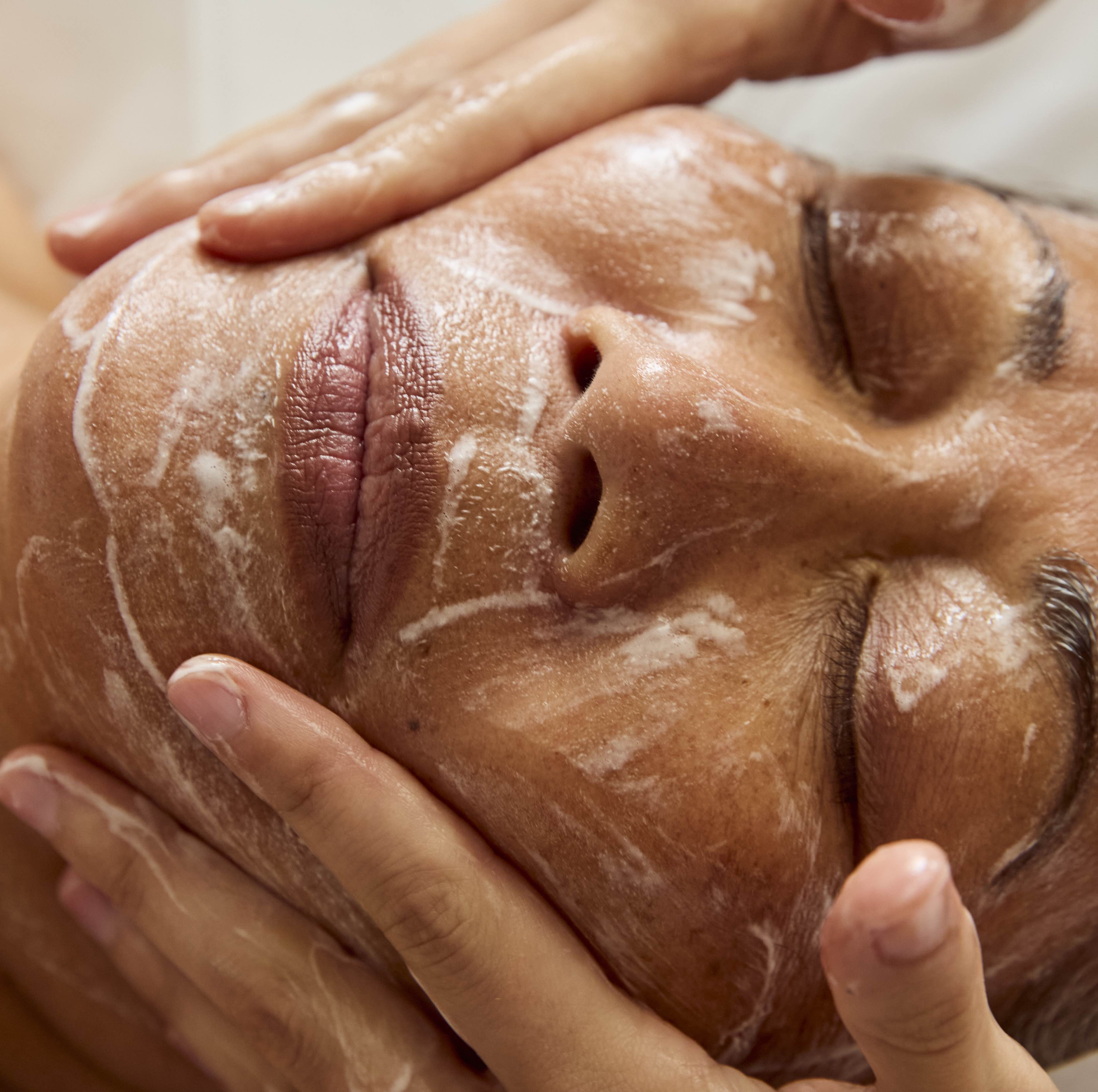 Biorepeel TCA  & Resurfacing
