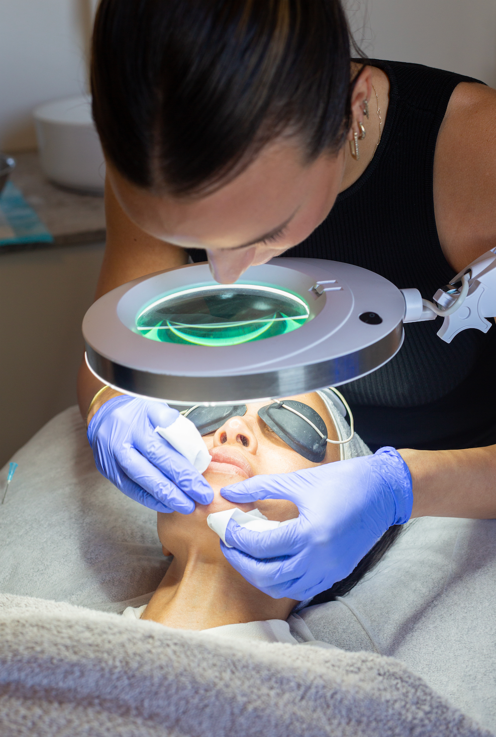 Alpha-Male Laser Facial