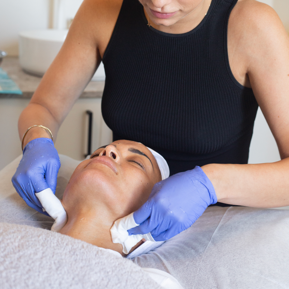 Laser Genesis and Cosmo Peel | anti-inflammatory skin treatment and chemical peel | skintoheart